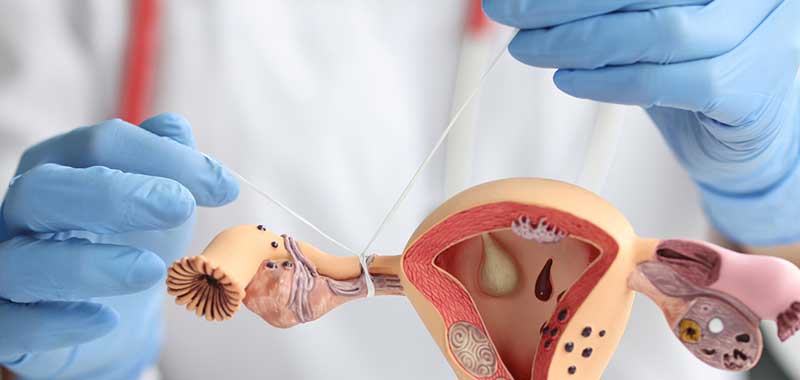 HSG Hysterosalpingography Tests